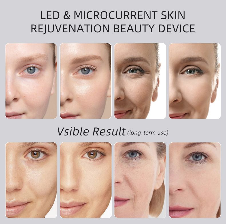 Beauty Device: Red and Blue Light, Home Use, Portable, Vibrating, Multi-Functional, with Voice Guidance, 5-Color Light Therapy, Eye Massage, Eye Care Device/"Upgrade" black beauty introducer