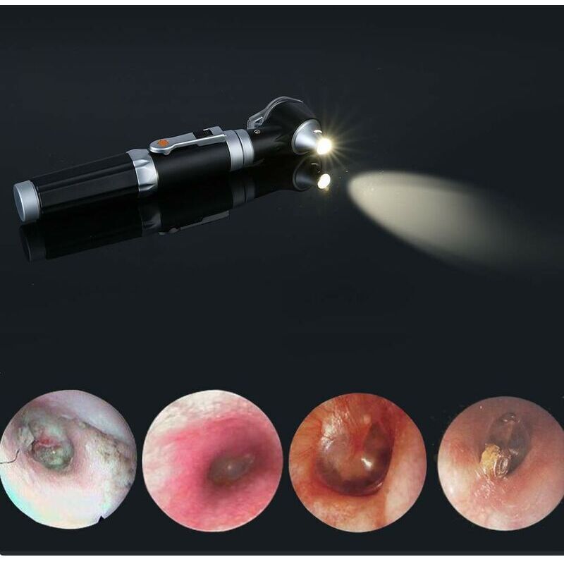 Mini Ear Otoscope, Magnification Diagnostic Inspection Ear Scope with LED Direct Illumination Ear Healthy Tool for Doctors Nurse Children